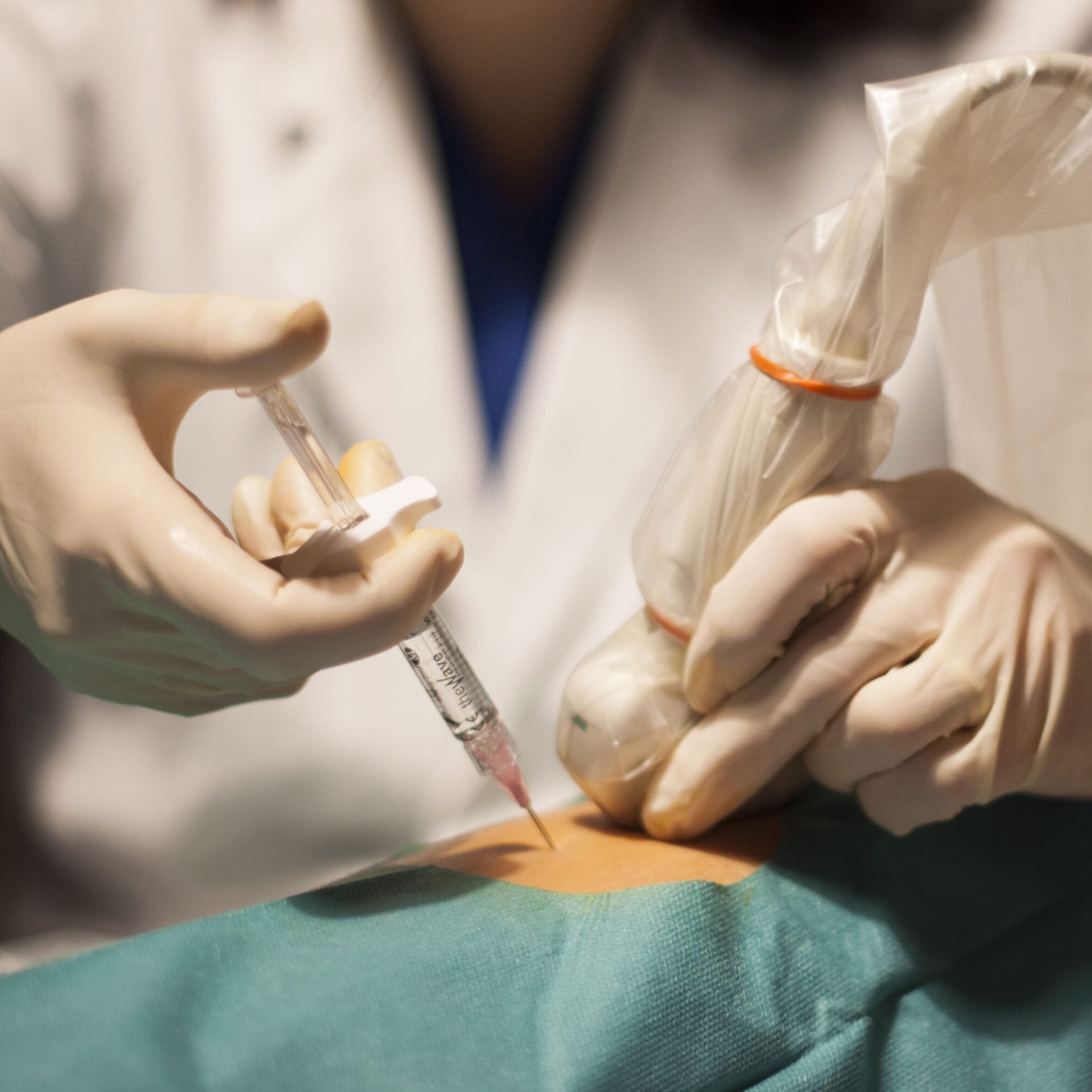 Infiltrazioni Di Cortisone Ecoguidate a Correggio