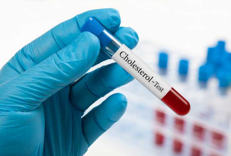 Cause del colesterolo: scopri quali sono le principali