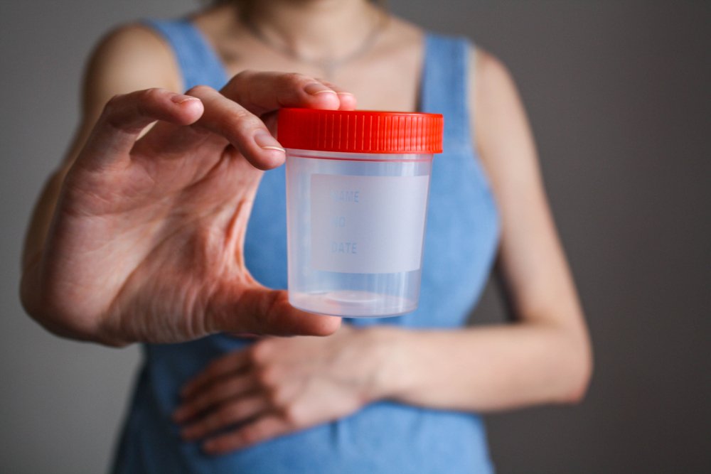 Urinocoltura positiva centro prelievi medicalpro correggio