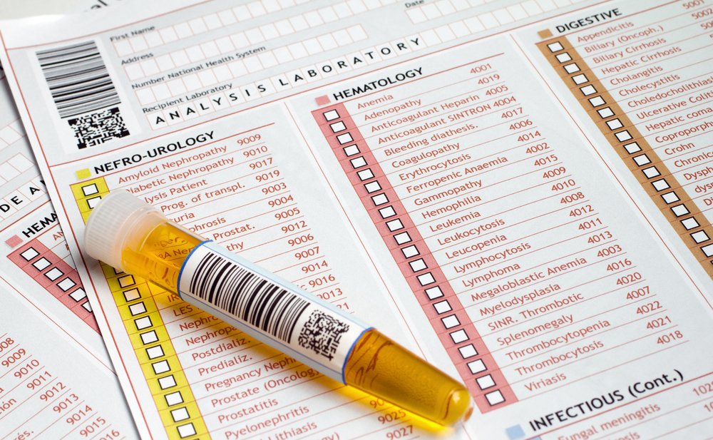 trattamenti post urinocoltura positiva. Centro analisi Correggio